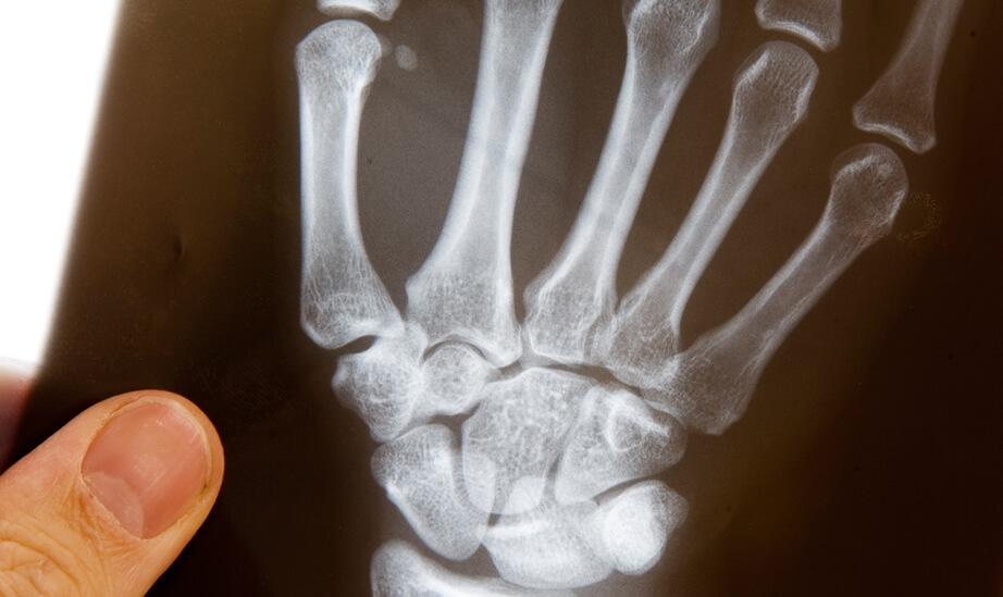 Handrehabilitation / Chirurgie Handrehabilitation / Chirurgie