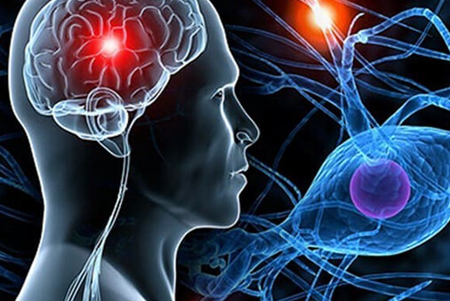 Neurologie Neurologie